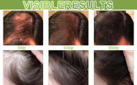 dr sebi batana oil for hair growth