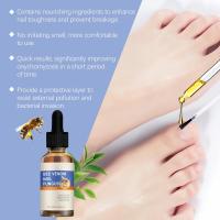 Solución para el cuidado de las uñas, Esencia para el cuidado de los hongos, Eliminación de la tiña, Gel antimicótico - details 7