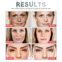 Crema Antiedad Reduce Líneas Finas Faciales Repara Felures Nasolabiales Hidrata y Reafirma la Piel - details 6