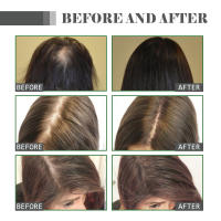 El aceite de esencia puede reparar y proteger, mejorar el daño irritante, fortalecer el cabello, hidratar el cabello - details 8