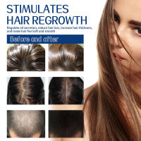 Crema limpiadora exfoliante para el cuero cabelludo, alivia la picazón, da volumen, hidrata, espesa, fija el cabello y - details 8
