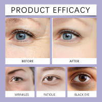 Retinol Hidratante Suave Hidratación Diaria Mase Cuidado de la Piel Crema para Ojos - details 8