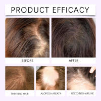 HOEGOA Esencia en Spray Nutritiva para el Cuero Cabelludo Hidratante y Suavizante Aceite Esencial para el Cuidado del Cabello - details 7