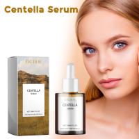 Suero de Centella que nutre la mejora de la piel seca, rejuvenecimiento suavizante, ilumina la hidratación, ácido hialurónico, esencia facial, cuidado de la piel - details 9
