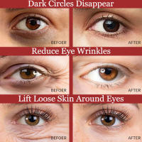Crema de Ojos de Retinol Serum para Ojos de Anti-envejecimiento para Lifting Facial Hidratante - details 10