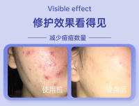 Máscara facial de rejuvenecimiento de la piel con fotones, dispositivo de belleza con espectro de siete colores - details 2
