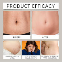 Aceite hidratante nutritivo para el cuidado de la piel corporal con vitamina E - details 8