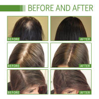 West&Montr hidrata cuida el aceite esencial para el cuidado del cabello seco, hidratante y suave - details 6