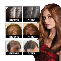 Hidrata, repara densamente las raíces, el cabello dañado, fortalece y reafirma el aceite esencial para el cuidado del cabello. - details 8