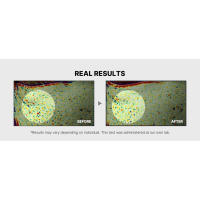 THE VISUAL RESULTS OF USING BOOSTER H, A KOREAN SKIN CARE DEVICE, FEATURED ON ALLURE TZR