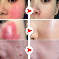 Crema de día correctora antienrojecimiento Facial, crema para el cuidado de la piel sensible a la picazón, crema hidratante para iluminar la Base, cosméticos - details 6