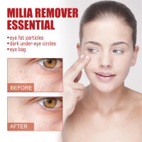 Crema para ojos eliminadora de gránulos de grasa, elimina las ojeras, bolsas para los ojos, desvanece las líneas finas, antihinchazón, arrugas, levanta el cuidado de la piel de los ojos reafirmante - details 1