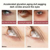 Crema de Ojos de Retinol Eliminación Inmediata de Ojeras Desvanecimiento de Líneas Finas - details 14
