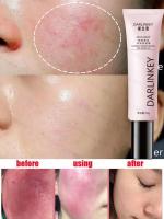 Crema de día correctora antienrojecimiento Facial, crema para el cuidado de la piel sensible a la picazón, crema hidratante para iluminar la Base, cosméticos - details 2