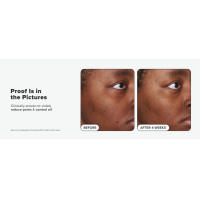Paula's Choice SKIN PERFECTING 2% BHA Exfoliante líquido de ácido salicílico-exfoliante facial para puntos negros, poros agrandados y arrugas - details 4
