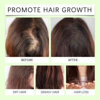 El aceite esencial acondicionador WOODSSLEEP para el cuidado del cabello es suave, hidratante y repara el cabello seco. La fragancia vegetal - details 8