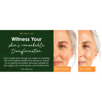 Before and after of a middle-aged woman, showing visible improvements from using Tree of Life serums