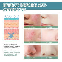 Crema reparadora de enrojecimiento Facial, mejora la sequedad de la piel sensible, loción hidratante, eliminación de rosácea, Cosméticos Coreanos - details 5