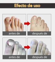 Herramienta integrada para manicura y pedicura de cutículas de uñas, alicates de tijera, cortador de bordes, 1 pieza - details 5