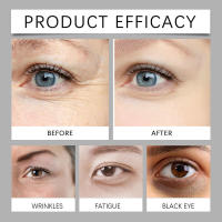 La crema para ojos con veneno de serpiente hidrata, reduce las arrugas, nutre y reafirma la piel alrededor de los ojos. La masa mejora la opacidad. - details 8