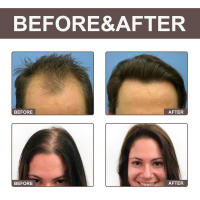 Mejora la sequedad, fortalece, nutre el cuero cabelludo y el cabello, aceite esencial para el cuidado del cabello. - details 7