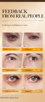 Suero para ojos antiarrugas con péptidos, Retinol, elimina la hinchazón debajo de las bolsas de los ojos, blanquea las ojeras, se desvanece, línea fina, aprieta los cosméticos coreanos - details 7