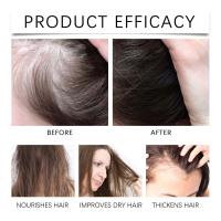 Aceite esencial de ricino para reparar el cuero cabelludo seco y dañado, hidratante, cabello denso, lo que lo hace suave y hermoso - details 8