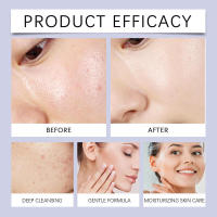 Gentle Soothing Cleanser es un limpiador hidratante que limpia la piel con una textura refrescante y no aprieta. - details 11