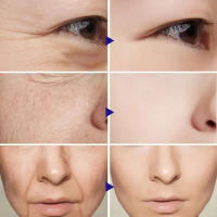 Crema eliminadora de arrugas Retinol, antienvejecimiento, se desvanece, líneas finas, levanta la piel firme, brillo e hidratación, cuidado de la piel, Cosméticos Coreanos - details 0