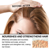 El cuidado con aceites esenciales fortalece y previene que se caiga suavemente. El cabello es fragante y natural. - details 3