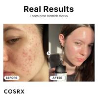 COSRX 15% Niacinamida Suero facial, 0.67 fl oz, Suero minimizador de poros para el rostro, Tono de piel uniforme, Cuidado de la piel coreano - details 1