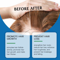 HOEGOA Essence Loción para el cuidado del cabello suavizante e hidratante suave y iluminadora - details 8