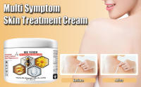 Multi Symptom Skin Treatment Cream