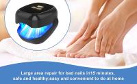 Dispositivo de luz LED para tratamiento láser de hongos en las uñas: infecciones por hongos en las uñas, ayuda a restaurar la salud y mejora significativamente los síntomas como deformación y caminar doloroso - details 5