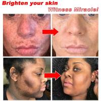 Crema Blanqueadora Astragalus Removedor de Manchas Dark Eyes Reparador de Melasma Hidratante - details 6