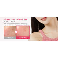 txa serum