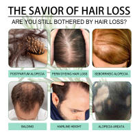 El romero nutre suavemente ilumina el cabello, hidrata y suaviza el aceite esencial para el cuidado del cabello - details 7