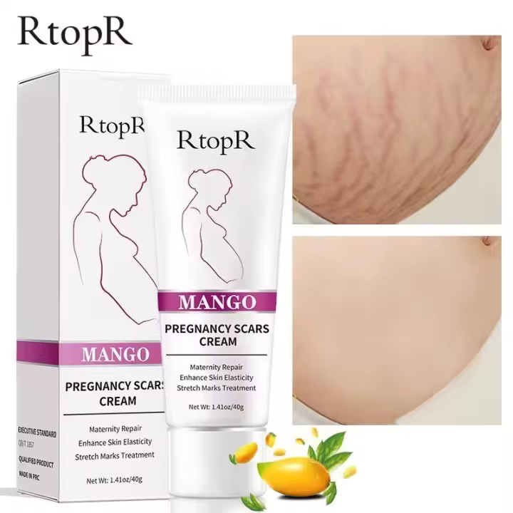 Crema de Belleza para la Piel Efectiva para Marcas de Embarazo, Acné, Reparación de la Piel - 1
