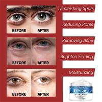 Crema Facial Retinol, cuidado Facial antienvejecimiento, reafirmante para la piel, Reduce las arrugas del cuello, manchas, producto de tratamiento Facial hidratante para la piel - details 2