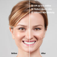 Dispositivo inteligente de belleza con microcorriente, luz roja y azul, vibración y lifting facial en V para adelgazar la cara, ¡en oferta! - details 8