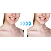 Masajeador Facial para el cuidado de la piel, dispositivo de belleza, reafirmante y reductor de doble mentón, mujeres y hombres - details 2