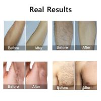 Epilador Láser Para Eliminación De Pelo Permanente Para Mujeres Y Hombres 999999 Flashes Para Cuerpo Bikini Piernas Axilas Y Brazos Sin Dolor - details 4