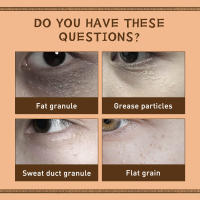 Crema para ojos de genciana, eliminador de gránulos de grasa, mejora la bolsa de los ojos, reafirmante, se desvanece, líneas finas, antihinchazón, hidratante, cuidado de la piel de los ojos - details 8