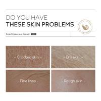 Crema de Caracol de Nutrición para Belleza Anti-envejecimiento Esencia, Removedor de Arrugas Faciales, Hidratante Herramientas de Cuidado de la Piel de Belleza 30g - details 8