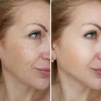 Crema eliminadora de arrugas Retinol, antienvejecimiento, se desvanece, líneas finas, levanta la piel firme, brillo e hidratación, cuidado de la piel, Cosméticos Coreanos - details 7