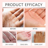 Crema de manos Retinol, cuidado hidratante con manteca de karité para líneas finas en las manos, mejora la sequedad y la nutrición - details 8