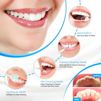 Limpiador de Dientes Ultrasonido Eléctrico para Remoción de Calculos y Taraturas Cuidado Oral Blanqueador de Dientes con Scaler - details 2