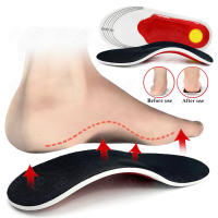 Plantillas deportivas ortopédicas para hombre y mujer, soporte para ARCO, suela de zapato ortopédica para pies planos, zapatos para correr, cojín para fascitis Plantar - details 0
