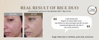 rice MASK
