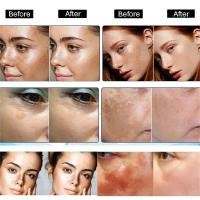 Suero Blanqueador Corrector de Manchas Dark Spots Iluminador de Piel para Día y Noche - details 12